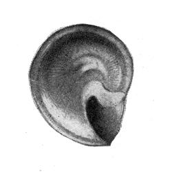 Teinostoma carinatum